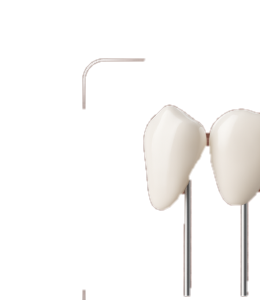 Veneers